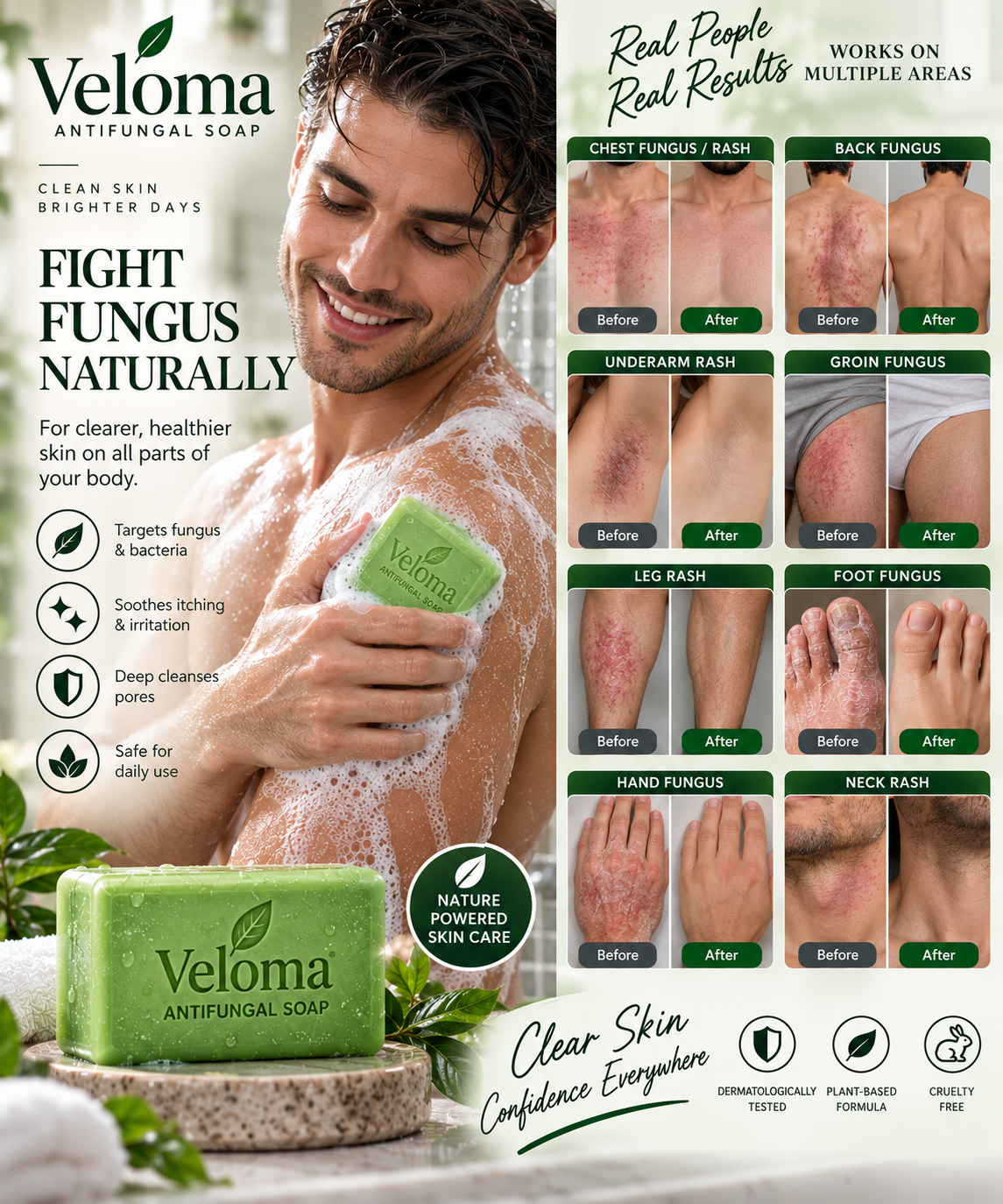 Veloma Anti-Fungal Soap product photo